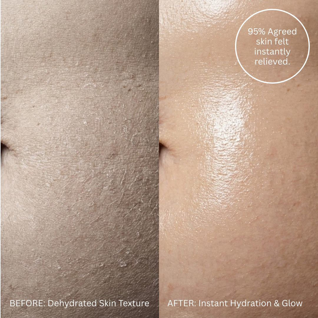 Belly Butter™ (for Stretch Marks)