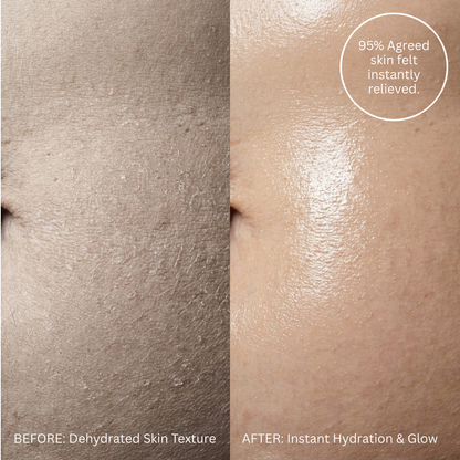 Belly Butter™ (for Stretch Marks)